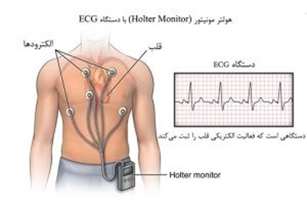 الکتروکاردیوگرام یا نوار قلب