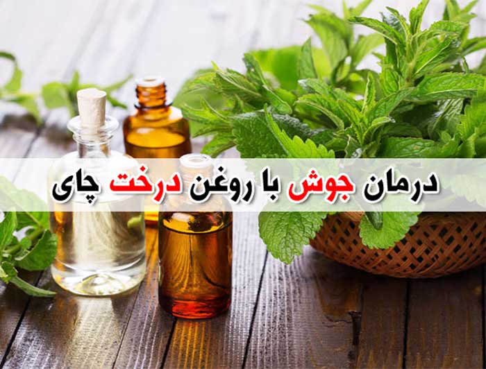 خواص روغن درخت چای برای جوش – درمان آکنه